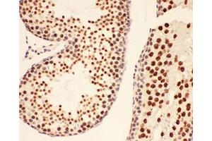 IHC-P testing of rat testis tissue (BRCA1 抗体  (AA 1661-1863))