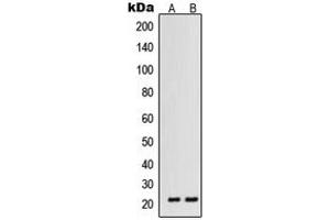 Western blot analysis of VEGFB expression in HT1080 (A), ACHN (B) whole cell lysates. (VEGFB 抗体  (Center))