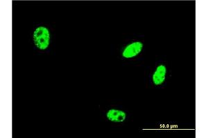 Immunofluorescence of monoclonal antibody to EHMT1 on HeLa cell. (EHMT1 抗体  (AA 1-100))