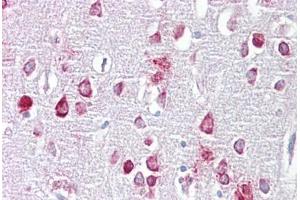 Anti-PPME1 antibody IHC staining of human brain, cortex. (PPME1 抗体  (AA 35-84))
