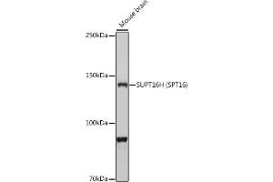 Western blot analysis of extracts of Mouse brain, using SUPT16H (SPT16) antibody (ABIN7267097) at 1:1000 dilution. (SUPT16H 抗体)