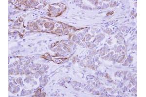 Image no. 1 for anti-WD Repeat Domain 49 (WDR49) (AA 343-666) antibody (ABIN1501751) (WDR49 抗体  (AA 343-666))