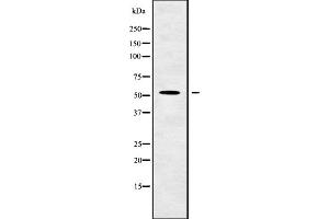 Western blot analysis GCNT4 using HuvEc whole cell lysates. (GCNT4 抗体)