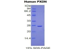 SDS-PAGE analysis of Human Peroxidasin Homolog Protein. (Peroxidasin 蛋白)