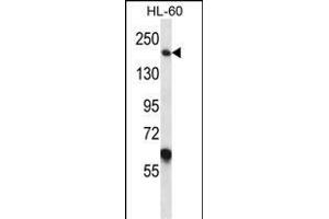 MYOM1 Antibody (Center) (ABIN657367 and ABIN2846414) western blot analysis in HL-60 cell line lysates (35 μg/lane). (Myomesin 1 抗体  (AA 904-933))