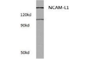 Western blot (WB) analysis of CD171 / L1CAM Antibody at 1/500 dilution in extracts from Raw264. (L1CAM 抗体)