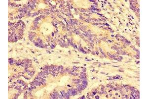 Immunohistochemistry (IHC) image for anti-Solute Carrier Family 28 (Sodium-Coupled Nucleoside Transporter), Member 3 (SLC28A3) (AA 1-102) antibody (ABIN7170219)