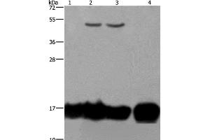 Western Blot analysis of A549 and K562 cell, Raji cell and Human fetal intestine tissue using IL17C Polyclonal Antibody at dilution of 1:250 (IL17C 抗体)