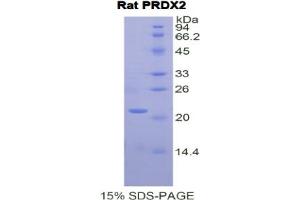 SDS-PAGE analysis of Rat Peroxiredoxin 2 Protein. (Peroxiredoxin 2 Protein (PRDX2))