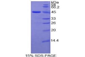SDS-PAGE analysis of Human MMP10 Protein. (MMP10 蛋白)