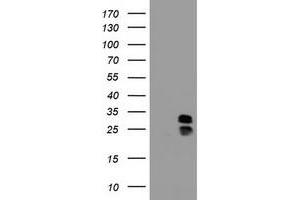 Image no. 2 for anti-Palmitoyl-Protein Thioesterase 1 (PPT1) (AA 100-306) antibody (ABIN1490801) (PPT1 抗体  (AA 100-306))