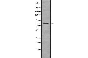 Western blot analysis of Cytochrome c Oxidase 1 using COLO205 whole cell lysates (COX1 抗体  (C-Term))