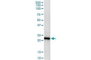 Immunoprecipitation of MAD2L2 transfected lysate using anti-MAD2L2 MaxPab rabbit polyclonal antibody and Protein A Magnetic Bead , and immunoblotted with MAD2L2 purified MaxPab mouse polyclonal antibody (B02P) . (MAD2L2 抗体  (AA 1-211))