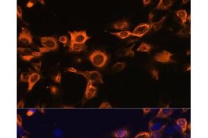 Immunofluorescence analysis of C6 cells using CSF2 Polyclonal Antibody at dilution of 1:100. (GM-CSF 抗体)