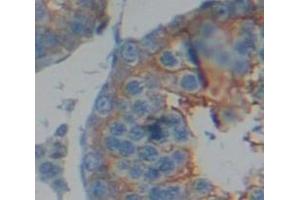 IHC-P analysis of Human Tissue, with DAB staining. (Dystrophin 抗体  (AA 3048-3328))