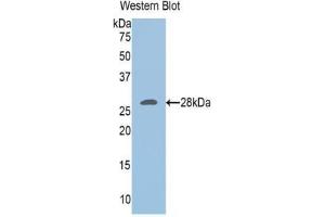 Western blot analysis of the recombinant protein. (UCHL3 抗体  (C-Term))