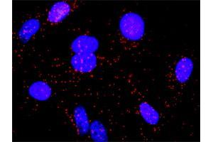 Proximity Ligation Analysis of protein-protein interactions between LCK and CD55. (LCK 抗体  (AA 1-539))