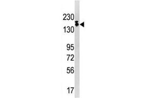 Western blot analysis of SETDB1 antibody and Ramos lysate. (SETDB1 抗体  (AA 1193-1225))