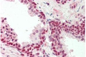 Human Prostate: Formalin-Fixed, Paraffin-Embedded (FFPE) (ZNF461 抗体  (AA 126-425))