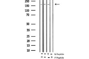 Western blot analysis of Phospho-Tuberin/TSC2 (Thr1462) Antibody expression in mouse brain and rat kidney tissues lysates.