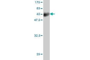 Western Blotting (WB) image for anti-Fc Fragment of IgE, Low Affinity II, Receptor For (CD23) (FCER2) (AA 1-321) antibody (ABIN560857)