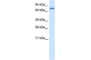 Human heart; WB Suggested Anti-ZNF84 Antibody Titration: 1. (ZNF84 抗体  (C-Term))