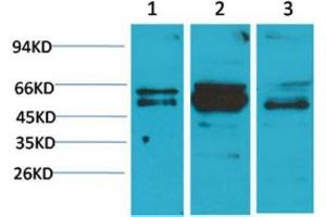 Western Blot (WB) analysis of 1) A431, 2)Mouse Brain Tissue, 3) Rat Brain Tissue with Flotllin-2 Rabbit Polyclonal Antibody diluted at 1:2000. (Flotillin 2 抗体)