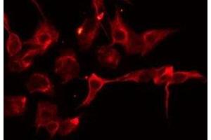 Immunofluorescence (fixed cells) (IF/ICC) image for anti-serpin Peptidase Inhibitor, Clade A (Alpha-1 Antiproteinase, Antitrypsin), Member 11 (SERPINA11) (N-Term) antibody (ABIN6258693)