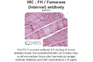 Image no. 2 for anti-Fumarate Hydratase (FH) (Internal Region) antibody (ABIN1734346) (FH 抗体  (Internal Region))