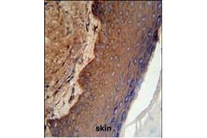 KRT9 Antibody (Center ) (ABIN652316 and ABIN2841447) IHC analysis in formalin fixed and paraffin embedded skin tissue followed by peroxidase conjugation of the secondary antibody and DAB staining. (KRT9 抗体  (AA 302-331))