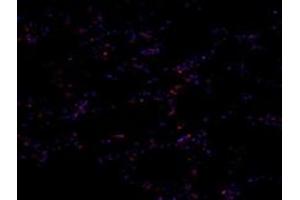 Immunofluorescent analysis of paraformaldehyde-fixed human para-cancer lung using PNN (ABIN7075083) at dilution of 1: 800 (PNN 抗体)