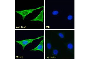 ABIN571025 Immunofluorescence analysis of paraformaldehyde fixed NIH3T3 cells, permeabilized with 0.