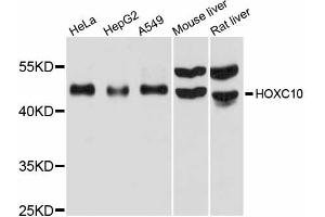 Western blot analysis of extracts of various cell lines, using HOXC10 antibody (ABIN6291152) at 1:1000 dilution. (HOXC10 抗体)