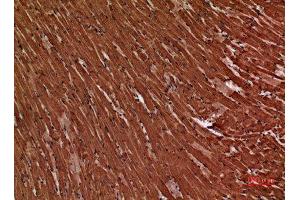 Immunohistochemistry (IHC) analysis of paraffin-embedded Mouse Heart, antibody was diluted at 1:100. (Troponin Complex T-C (Internal Region) 抗体)