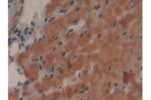 Immunohistochemistry (IHC) image for anti-Collagen, Type I, alpha 1 (COL1A1) (AA 1225-1453) antibody (ABIN7431647)