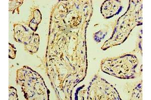 Immunohistochemistry of paraffin-embedded human placenta tissue using ABIN7150869 at dilution of 1:100 (DNAH3 抗体  (AA 1-150))