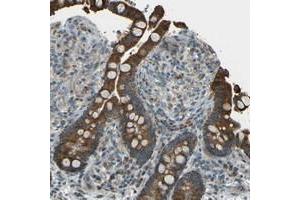Immunohistochemical staining of human colon with TMEM130 polyclonal antibody  shows strong cytoplasmic positivity in glandular cells. (TMEM130 抗体)