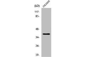 Western Blot analysis of COLO205 cells using XRCC4 Polyclonal Antibody (XRCC4 抗体  (C-Term))