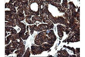 Image no. 6 for anti-Armadillo Repeat Containing 1 (ARMC1) antibody (ABIN1496724)