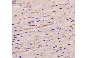 Immunohistochemistry of paraffin embedded mouse heart using Neil1 (ABIN7073820) at dilution of 1: 1200 (400x lens)