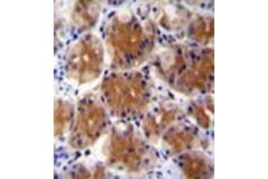 Formalin fixed and paraffin embedded human stomach tissue reacted FAM108C1 Antibody (Center) followed by peroxidase conjugation of the secondary antibody and DAB staining. (ABHD17C 抗体  (Middle Region))