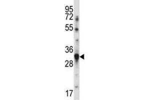 BAFF antibody western blot analysis in MDA-MB231 lysate. (BAFF 抗体  (AA 16-44))
