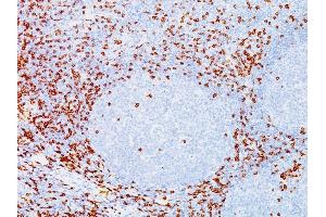 Formalin-fixed, paraffin-embedded human Tonsil stained with CD8A Mouse Monoclonal Antibody (C8/144B). (CD8 alpha 抗体  (C-Term, Cytoplasmic Domain))