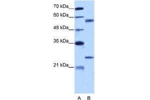 WB Suggested Anti-CPNE1 Antibody Titration:  5. (CPNE1 抗体  (N-Term))