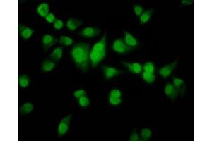 Immunofluorescence staining of Hela cells with ABIN7155703 at 1:100, counter-stained with DAPI. (HMX2 抗体  (AA 1-150))