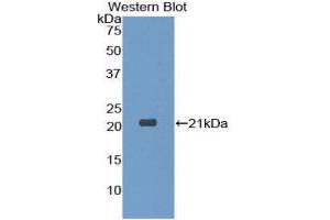Western Blotting (WB) image for anti-Dermatopontin (DPT) (AA 26-197) antibody (ABIN1175687) (Dermatopontin 抗体  (AA 26-197))