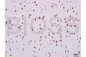 Immunohistochemistry (IHC) image for anti-Acidic (Leucine-Rich) Nuclear phosphoprotein 32 Family, Member C (ANP32C) (AA 81-180) antibody (ABIN759941)