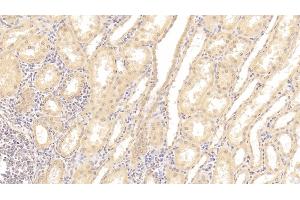 Detection of TNFRSF19 in Human Kidney Tissue using Polyclonal Antibody to Tumor Necrosis Factor Receptor Superfamily, Member 19 (TNFRSF19) (TNFRSF19 抗体  (AA 35-160))