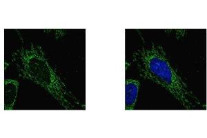 ICC/IF Image SUCLG1 antibody detects SUCLG1 protein at mitochondria by confocal immunofluorescent analysis. (SUCLG1 抗体)