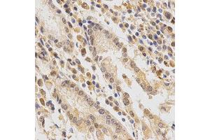 Immunohistochemistry (IHC) image for anti-Feline Sarcoma Oncogene (FES) antibody (ABIN1872678) (FES 抗体)